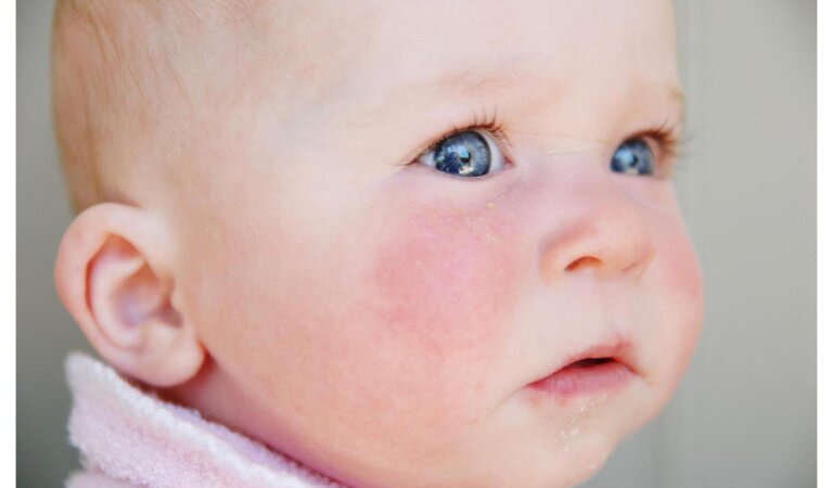 Chemicals Harmful to Baby Skin