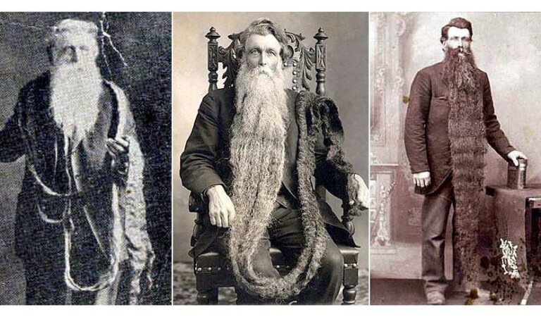 Hans Steininger, Who Was Killed with His Own Beard, Went Down in History as the Longest Bearded Man of the Era