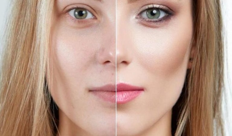 5 Secrets to Looking Younger Without Having Aesthetics Done